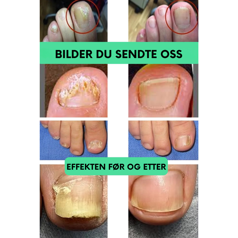 OnyxOil™ | Gi neglene dine en ny start
