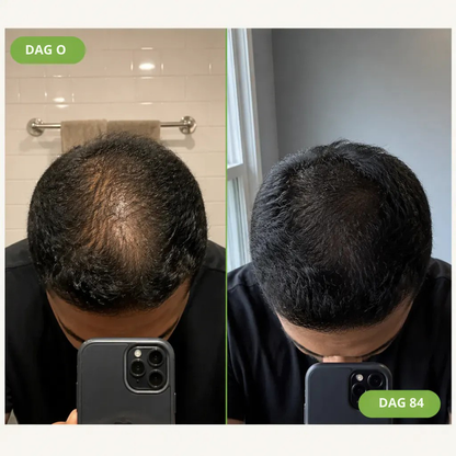 RootBoost™ | Start med hodebunnen for fyldigere hår