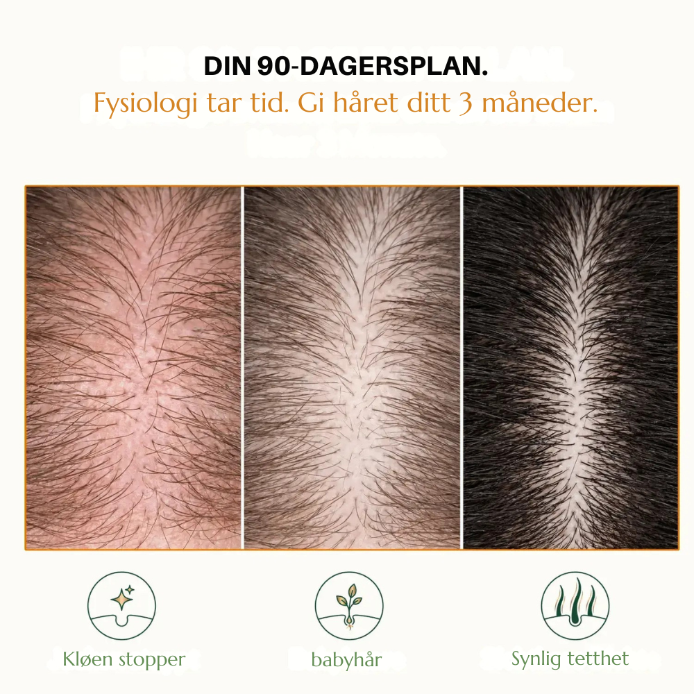 HairVital™ | Styrk håret ditt innenfra og opplev mer volum igjen
