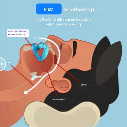 SnorkeStop™ | Få ro i soverommet og våkn opp frisk og uthvilt