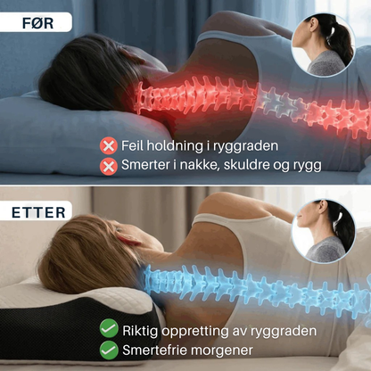 ErgoPillow™ | Gi nakken den støtten den har manglet hver natt
