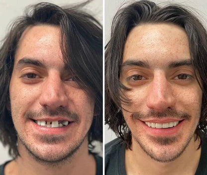 DentSecure™ | Få et sterkt, sikkert og bekymringsfritt smil hele dagen
