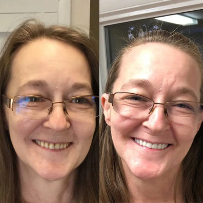 DentSecure™ | Få et sterkt, sikkert og bekymringsfritt smil hele dagen