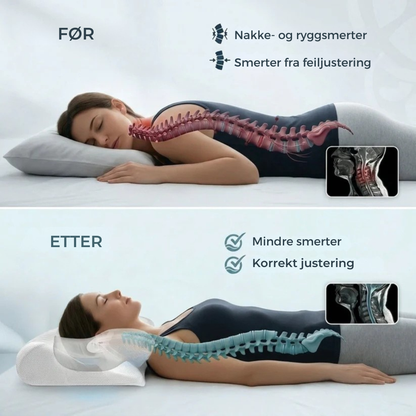 ErgoPillow™ | Gi nakken den støtten den har manglet hver natt