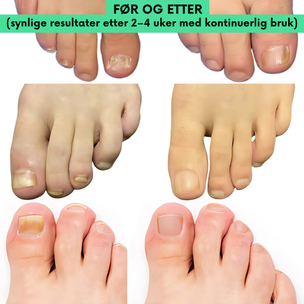 OnyxOil™ | Gi neglene dine en ny start