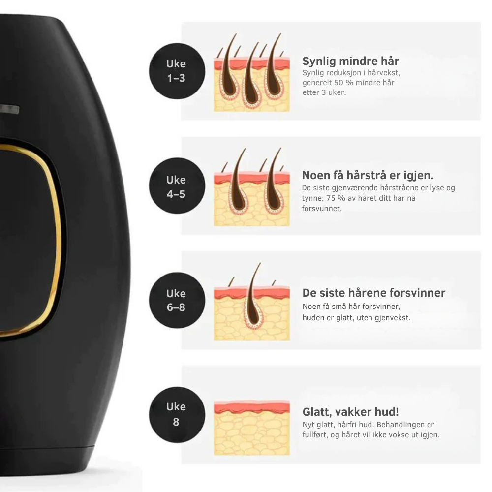 SmoothTouch IPL™ | Permanent hårfjerning – skånsom teknologi for en glatt hud hele året