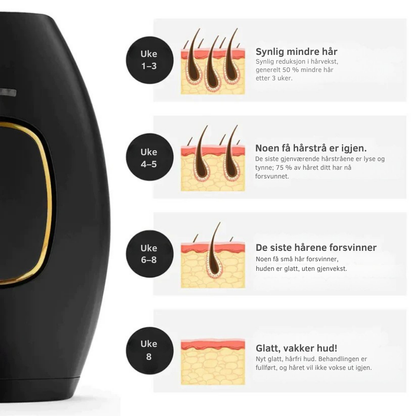 SmoothTouch IPL™ | Permanent hårfjerning – skånsom teknologi for en glatt hud hele året