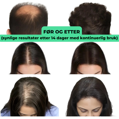 RootRevive™ | Få fyldigere hår og mer selvtillit