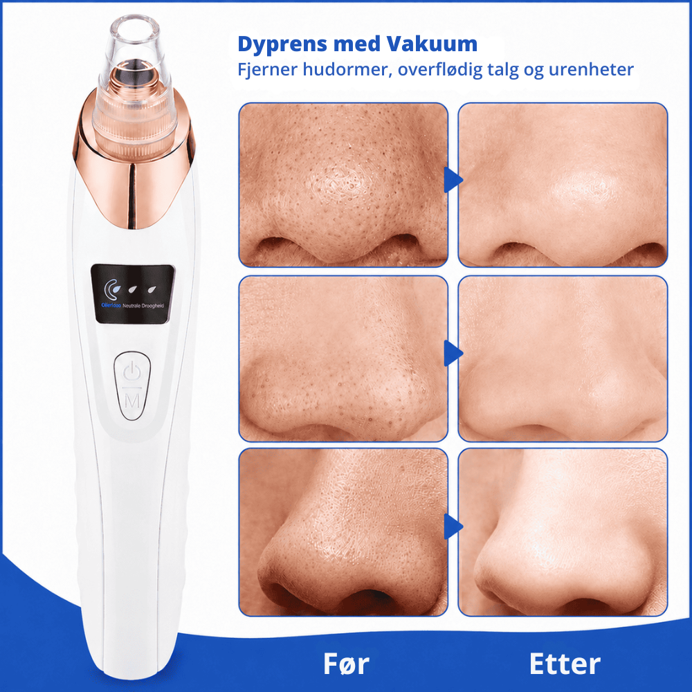 ClearPore™ | Målrettet porepleie for synlig renere hud