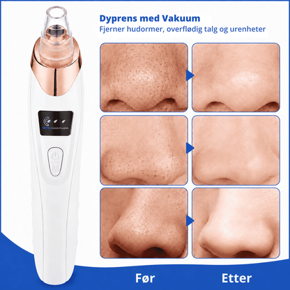 ClearPore™ | Målrettet porepleie for synlig renere hud