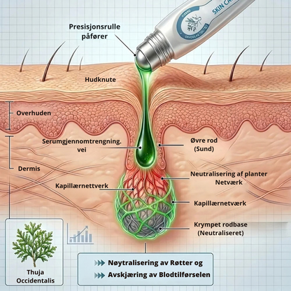 SkinClear™ | Målrett synlige flekker akkurat der de er