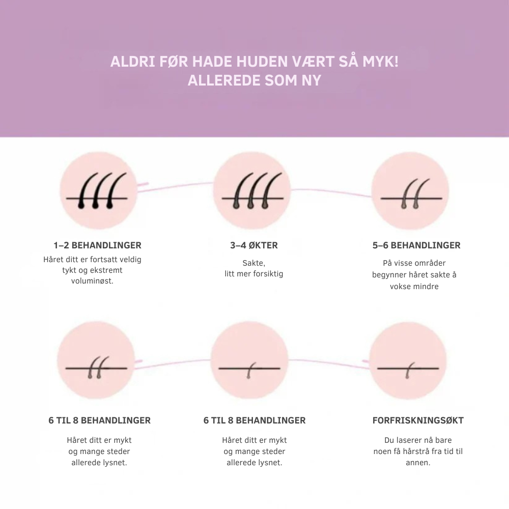 SmoothTouch IPL™ | Permanent hårfjerning – skånsom teknologi for en glatt hud hele året