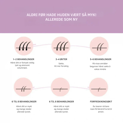 SmoothTouch IPL™ | Permanent hårfjerning – skånsom teknologi for en glatt hud hele året
