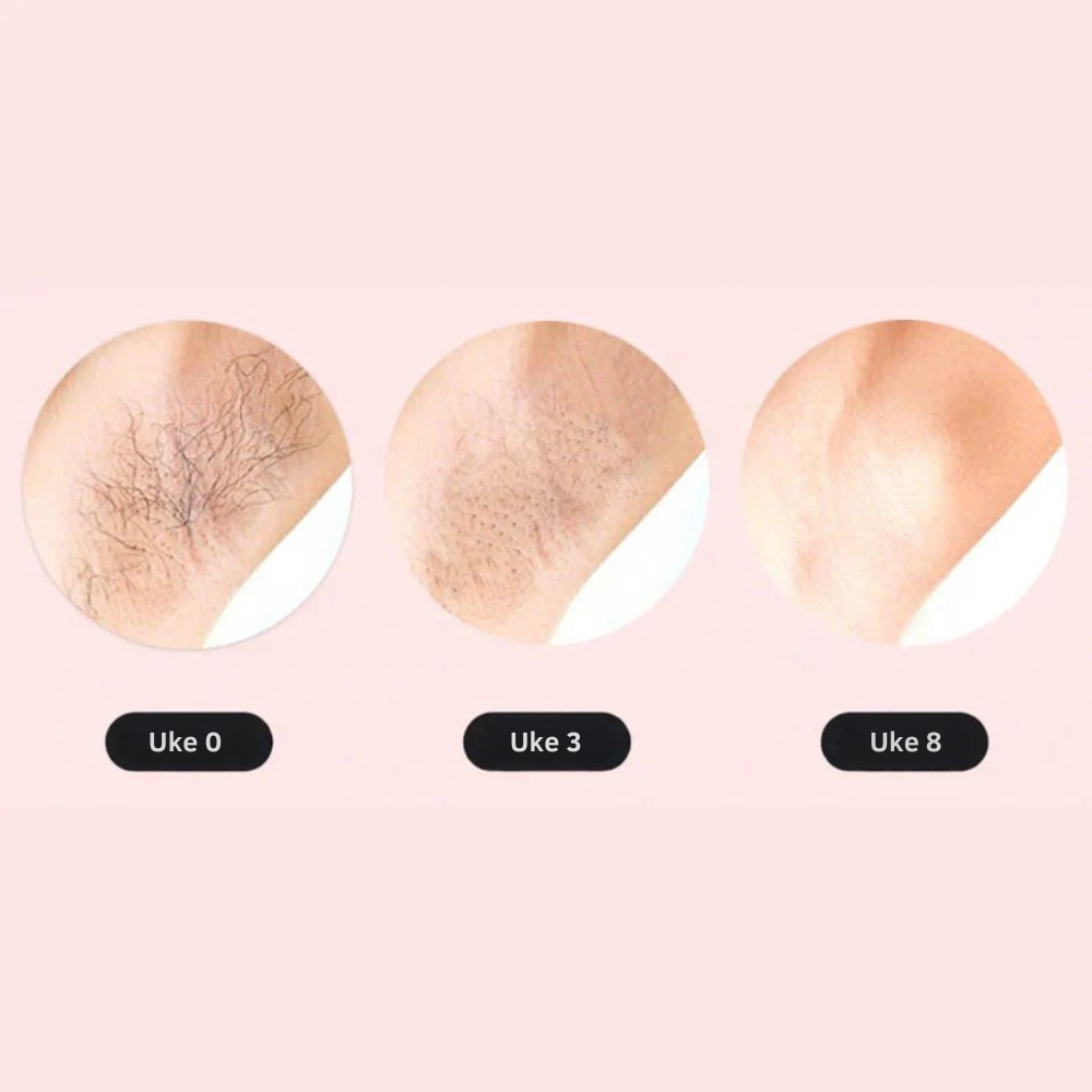 SmoothTouch IPL™ | Permanent hårfjerning – skånsom teknologi for en glatt hud hele året