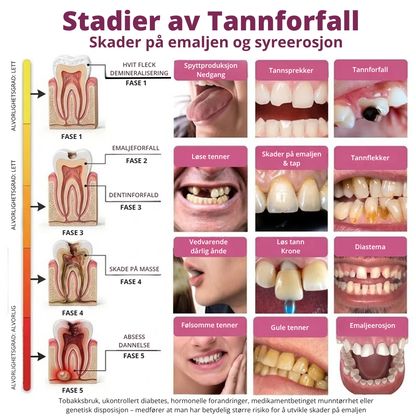 DenPerm™ | Målrettet pleie for svekket tannemalje