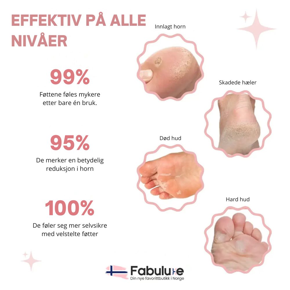 SmoothStep™ | Mykere føtter uten dyre behandlinger