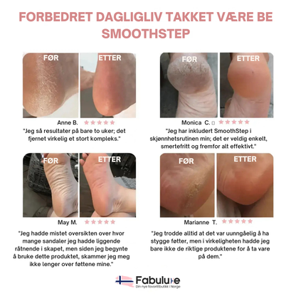 SmoothStep™ | Mykere føtter uten dyre behandlinger
