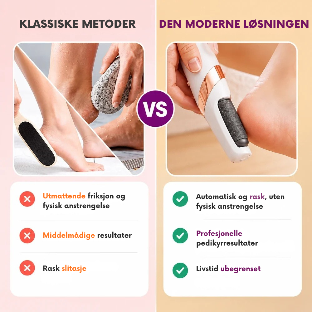 PediSmooth™ | Elektrisk fotpleie for myke, velpleide hæler hjemme