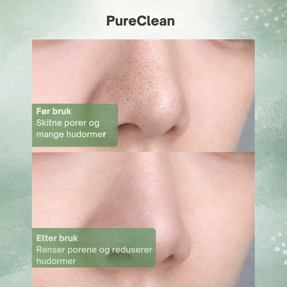 PureClean™ | Klar hud starter med rene porer
