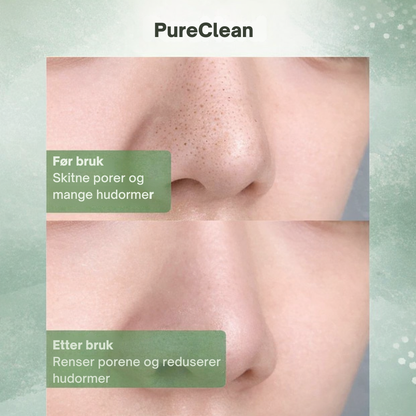 PureClean™ | Klar hud starter med rene porer