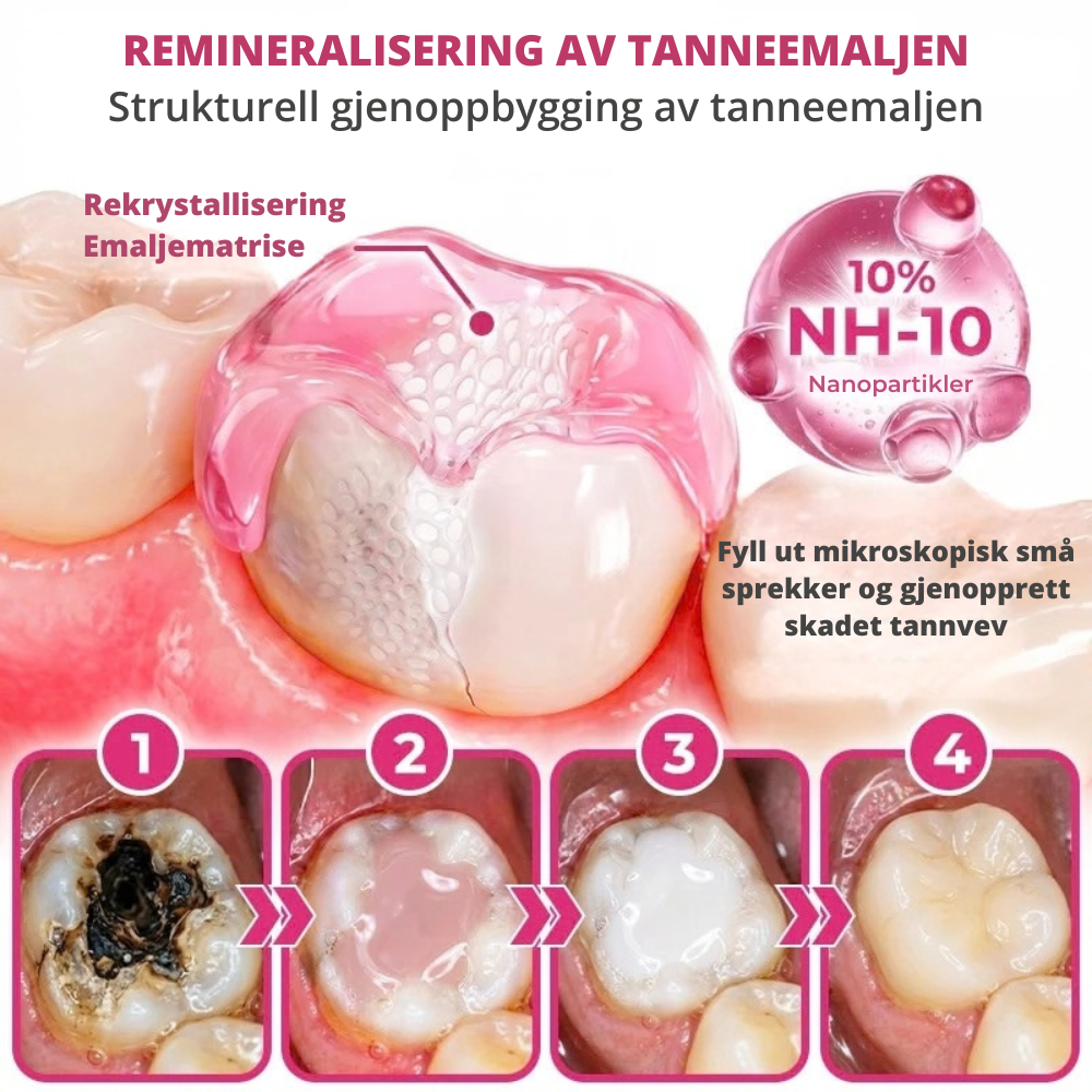 DenPerm™ | Målrettet pleie for svekket tannemalje
